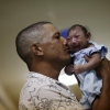 Zika virus and microcephaly among babies in Brazil
