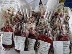 Ban on Gay Men Blood Donation 