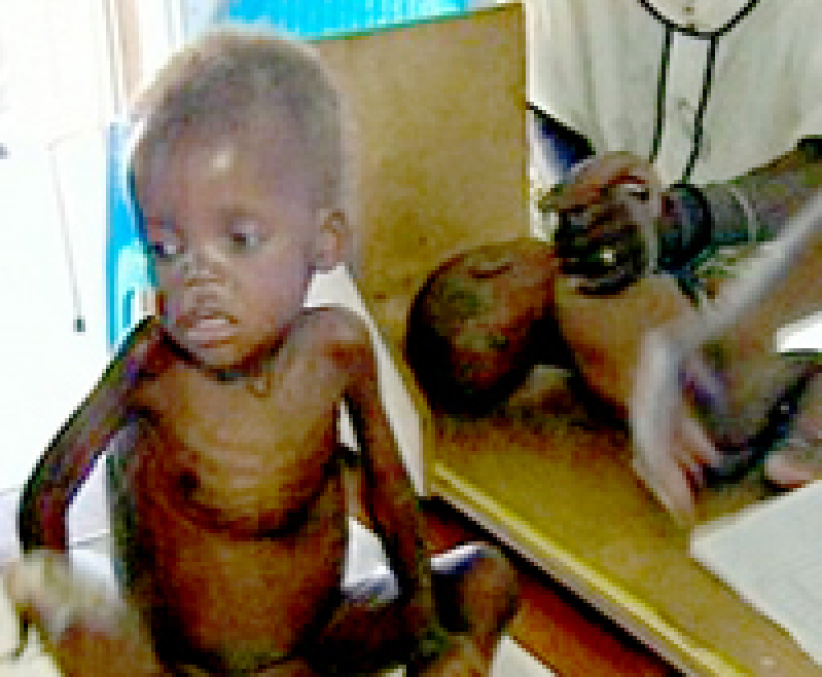 聯合國糧食計劃署：「世界忽視了飢餓問題」