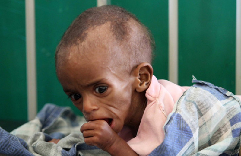 somalia-famine.jpg