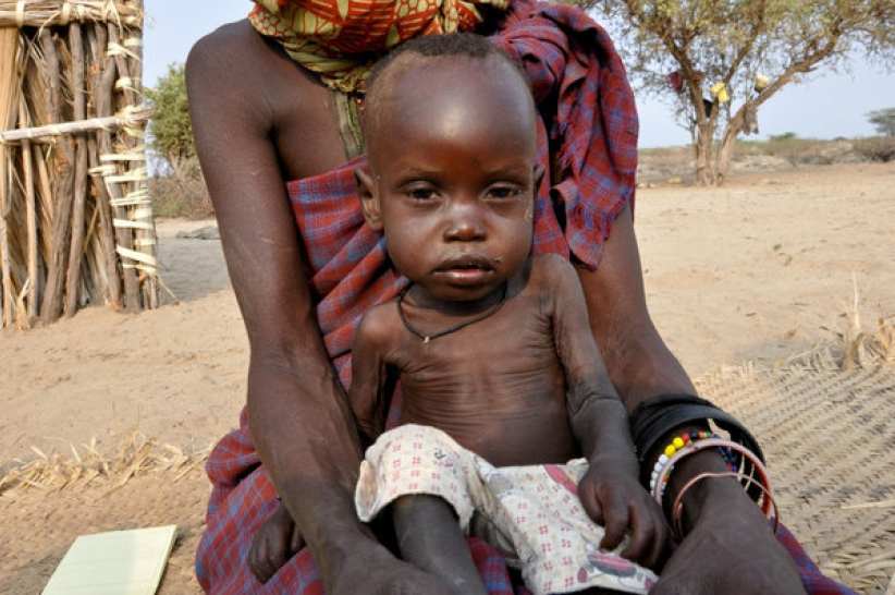 索馬里陷饑荒  宣明會目標全球籌四億港元急援東非三國