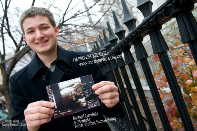 超聲波照片傳達「反墮胎，尊重生命」信息