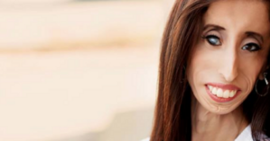 Lizzie Velasquez,