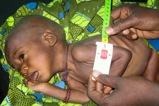 西非糧食危機告急  1500萬人缺糧