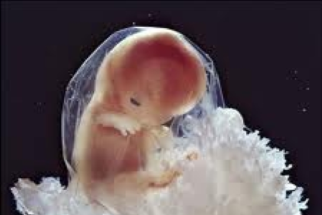 陳盧美馨:「人」在加國法例中的定義