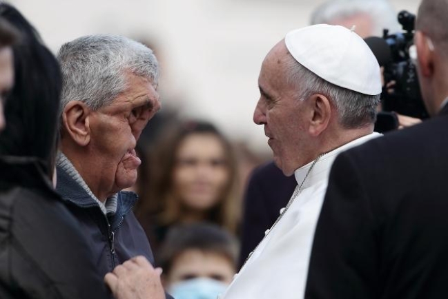 教宗方濟擁抱「陷臉人」感動世界