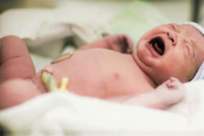 西弗吉尼亞州立法 醫生有責救活流產嬰兒