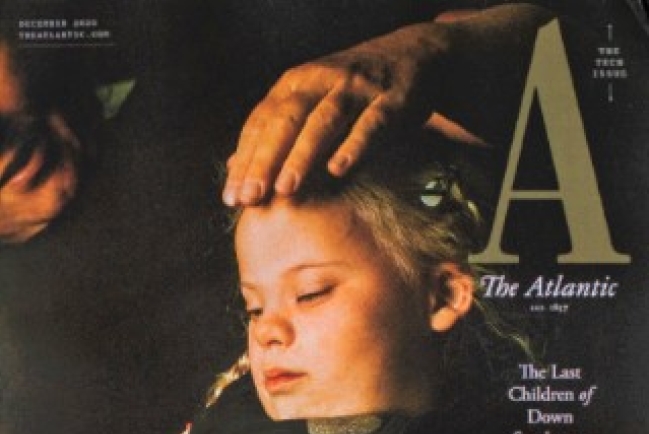 丹麥打掉唐氏症胎兒推崇優生? 文化期刊報導掀爭議