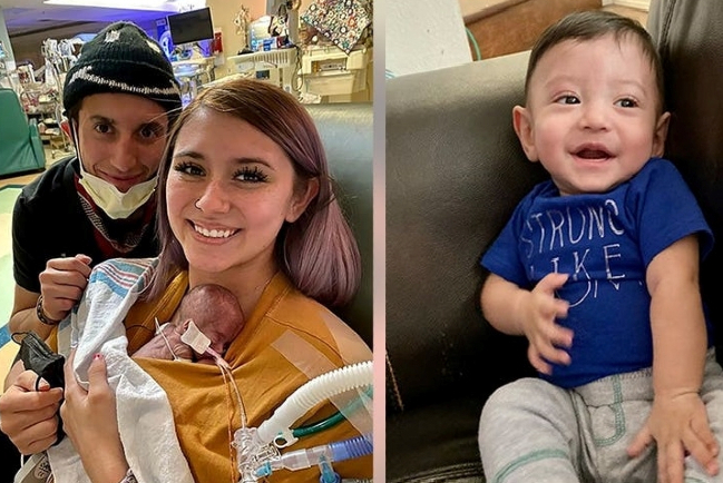 美國微型嬰兒奇蹟活著 迎來1歲生辰