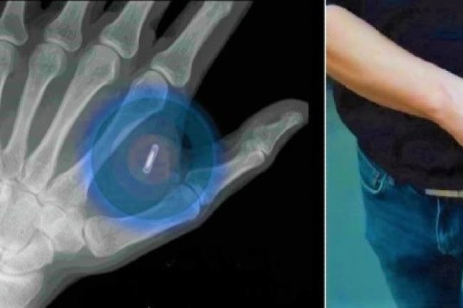 皮下植入微晶片 疫苗護照創先河