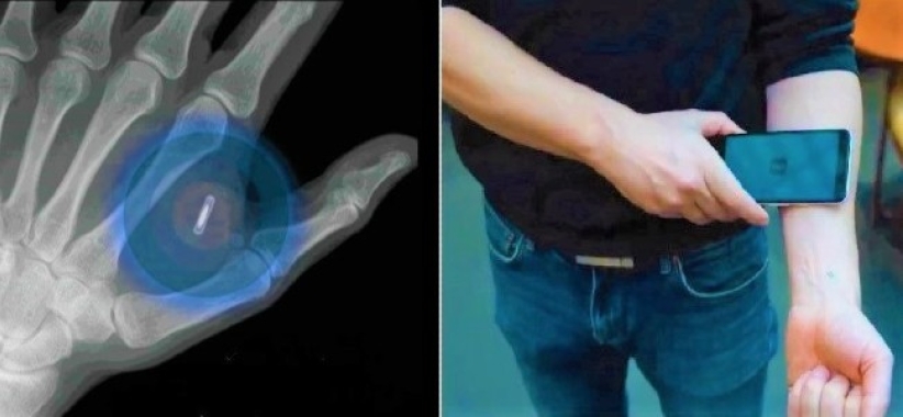 皮下植入微晶片 疫苗护照创先河  