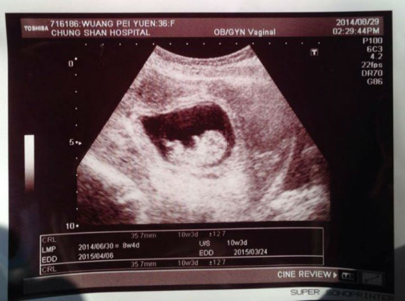 刘畊宏王婉霏怀第三胎 称上帝所赐超乎所求