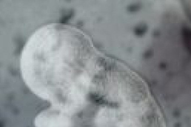 幹細胞研究在世界範圍內日益引起關注