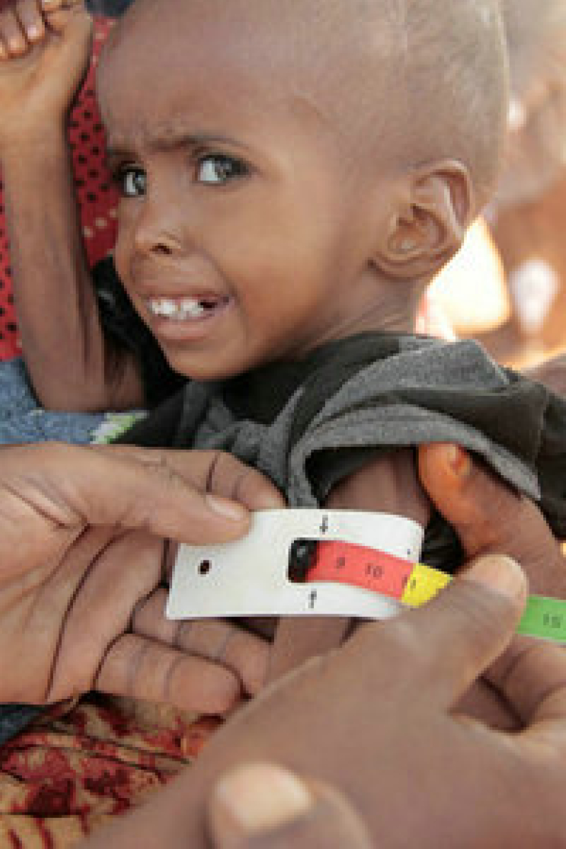 索馬里饑荒蔓延 東非50萬名兒童危在旦夕