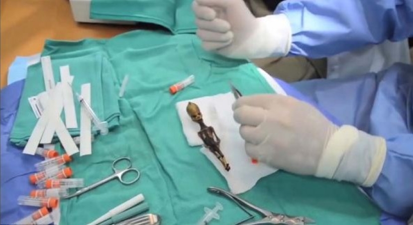 紀錄片《天狼星》為迷你「外星人」揭秘