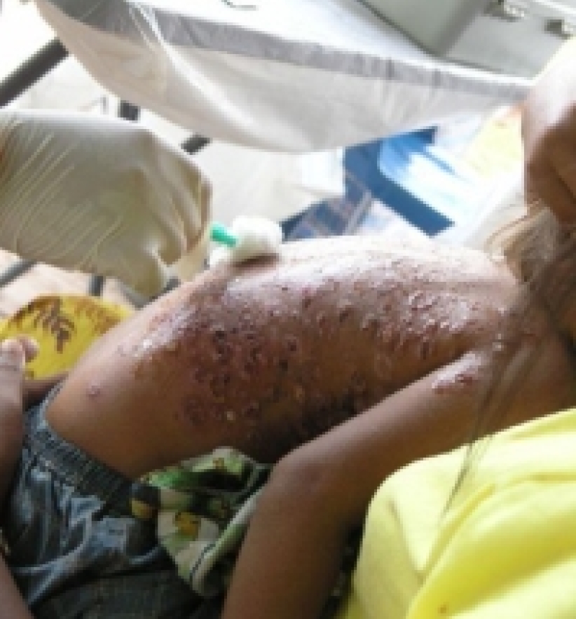 ICC於柬埔寨設醫療所提供義診