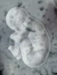 聯合國委員會通過 禁止各種形式複製人研究