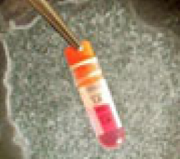 澳洲立法者權衡幹細胞法案