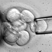 人類胚胎幹細胞試驗獲批准 挑戰生命倫理爭議