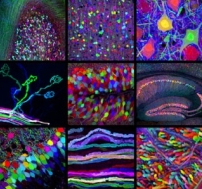 IQ是否可以提昇