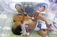 創世電視同工赴四川 領雙頭嬰一家信主