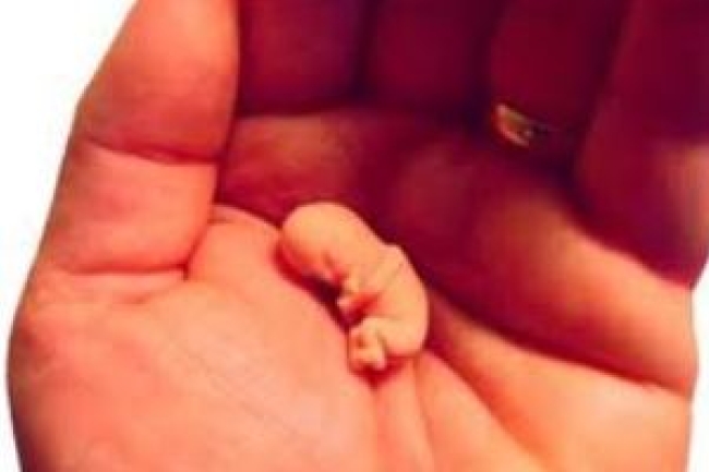 禁果吃出禍 比利時英國年均四少女一墮胎