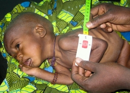 西非糧食危機告急  1500萬人缺糧