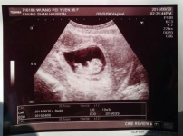 劉畊宏王婉霏懷第三胎 稱上帝所賜超乎所求