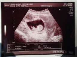 劉畊宏王婉霏懷第三胎 稱上帝所賜超乎所求