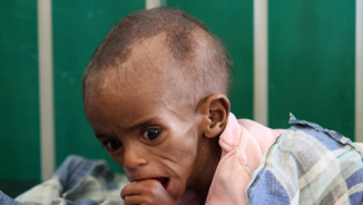 29,000 Children Die in Somalia Famine
