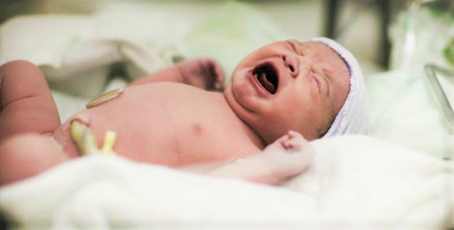 西弗吉尼亞州立法 醫生有責救活流產嬰兒